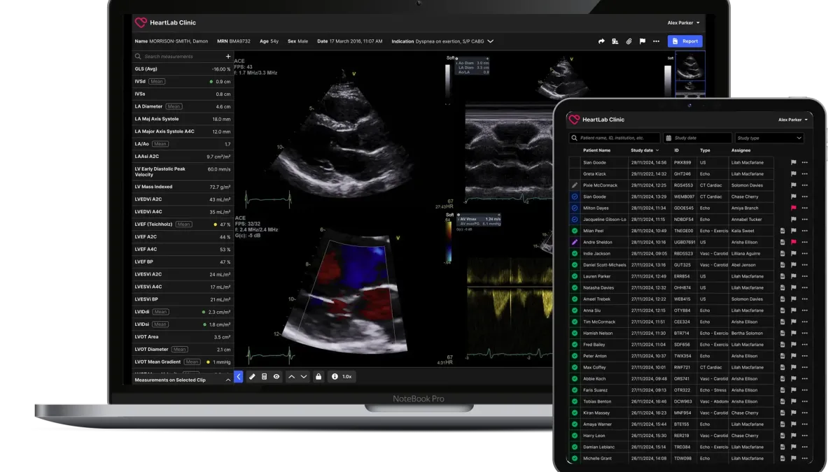 HeartLab worklist and imaging viewer shown across a laptop and tablet