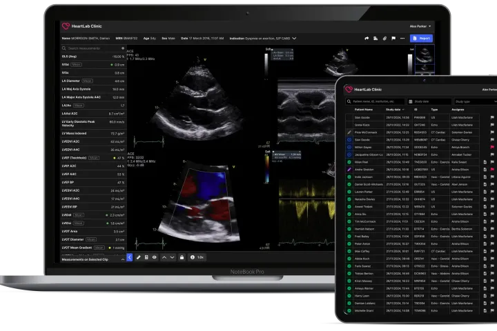 HeartLab worklist and imaging viewer shown across a laptop and tablet