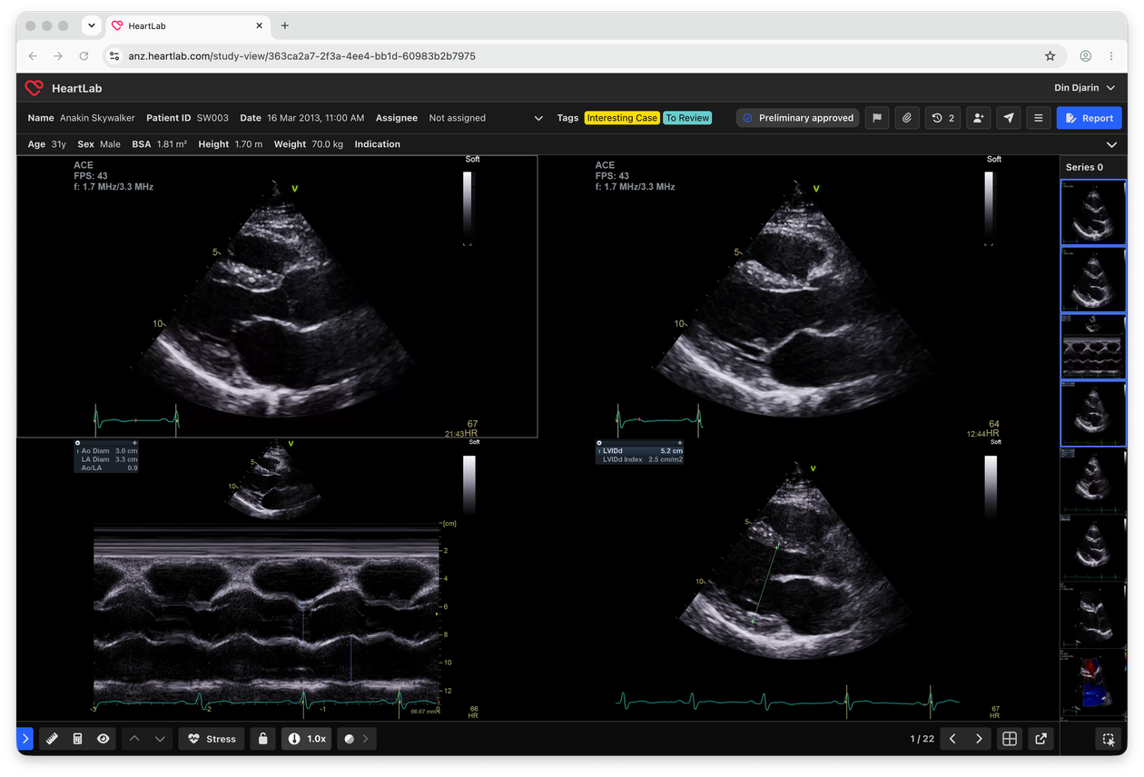 HeartLab cardiac imaging interface